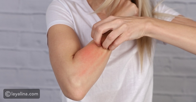 كيفية التعامل مع التهاب الجلد الناتج عن مستحضرات التجميل: نصائح فعّالة