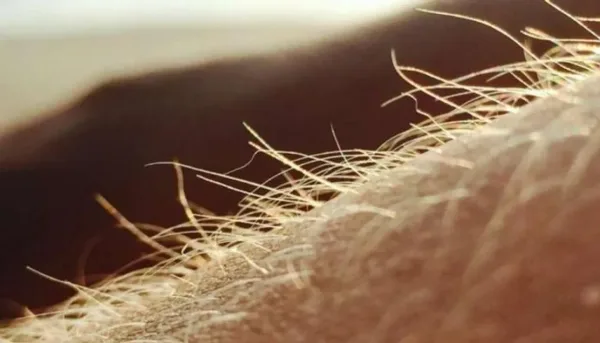 كيف تعمل بصيلات الشعر كرادارات مناعية طبيعية؟