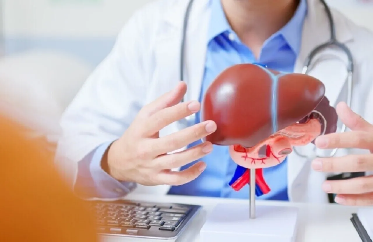 اكتشاف عوامل خطر غير متوقعة لمرض الكبد الدهني