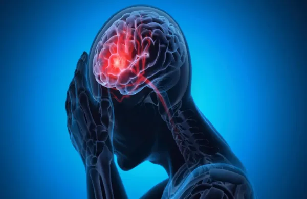 عامل خطر غير متوقع للجلطة الدماغية