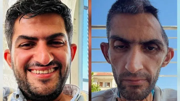 “الخبز كان حلمًا”.. مجاهد بني مفلح: تجربة اعتقال وعلاج حفرت في الروح قبل الجسد