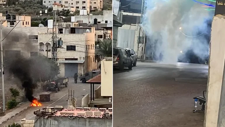 إصابة شاب بجروح في الوجه وحالات اختناق خلال اقتحام الاحتلال حفل زفاف في حزما