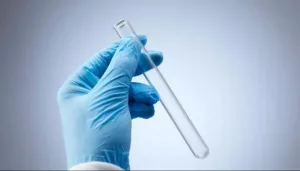 عودة شبح الطاعون.. وفاة فنية مختبر في روسيا وبدء إجراءات عزل