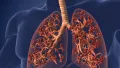 كيف تدعم رئتيك طبيعيًا؟.. 8 خطوات بسيطة قد تُحدث فرقًا