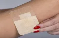 ابتكار ضمادة معدنية لوقف النزيف
