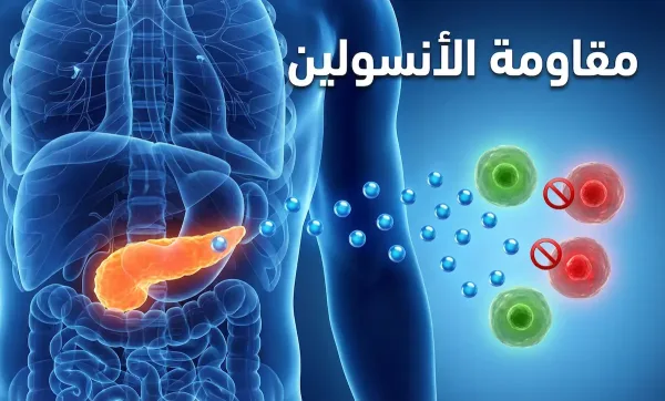 علامات أولية لمقاومة الإنسولين في الجسم.. إشارات قد لا تنتبهين إليها