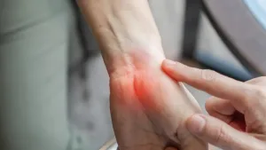 7 أطعمة ومشروبات قد تفاقم التهاب المفاصل.. تجنّب الإفراط فيها