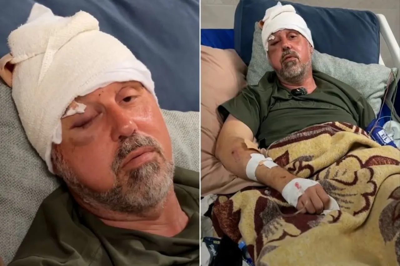 200 غرزة في رأسه.. مستوطنون يعتدون على فلسطيني أمريكي بالضفة