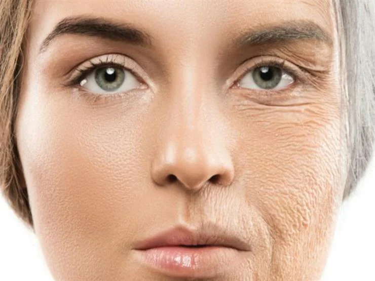 لماذا يسبب غسل الوجه بالماء الساخن ظهور التجاعيد المبكرة وجفاف الجلد؟