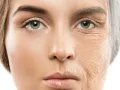 لماذا يسبب غسل الوجه بالماء الساخن ظهور التجاعيد المبكرة وجفاف الجلد؟